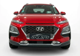 Hyundai Kona 1.6TGDI#CAMERA#PODGREV#DISTRONIC#EXCLUSIVE# - 29992 лв. / 15334.67 € - 89922534 2 | Car24.bg Hyundai Kona 1.6TGDI#CAMERA#PODGREV#DISTRONIC#EXCLUSIVE# - 29992 лв. / 15334.67 € - 89922534 2
