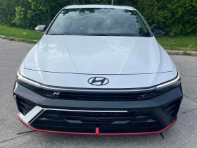 Hyundai Elantra | DCT | АВТОКРЕДИТ БЕЗ ПЪРВОНАЧАЛНА ВНОСКА | | Auto.bg — изображение 5 Hyundai Elantra | DCT | АВТОКРЕДИТ БЕЗ ПЪРВОНАЧАЛНА ВНОСКА | | Auto.bg — изображение 5