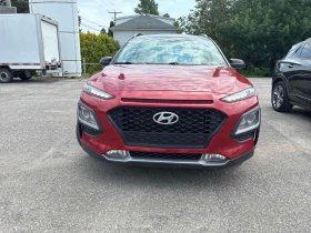 Hyundai Kona * Preferred * CARFAX * ОПЦИЯ ЗА ФИНАНСИРАНЕ | Auto.bg — изображение 6 Hyundai Kona * Preferred * CARFAX * ОПЦИЯ ЗА ФИНАНСИРАНЕ | Auto.bg — изображение 6