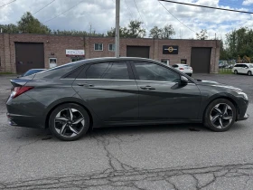 Hyundai Elantra | 31K KM ВЪЗМОЖНОСТ ЗА НАМАЛЯНЕ НА ЦЕНАТА CARFAX, снимка 3