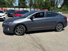 Hyundai Elantra * Ultimate * АВТОКРЕДИТ БЕЗ ПЪРВОНАЧАЛНА ВНОСКА* , снимка 2