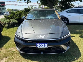 Hyundai Elantra  N Line | АВТОКРЕДИТ БЕЗ ПЪРВОНАЧАЛНА ВНОСКА | , снимка 6