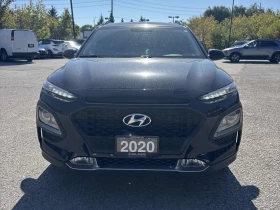 Обява за продажба на Hyundai Kona * АВТО КРЕДИТ* ЦЕНА ДО БГ * CARFAX *  ~26 999 лв. - изображение 1