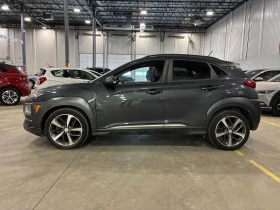 Hyundai Kona Ultimate  CARFAX, снимка 2