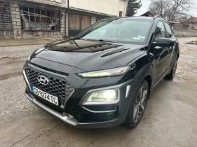     Hyundai Kona 1.6T limited