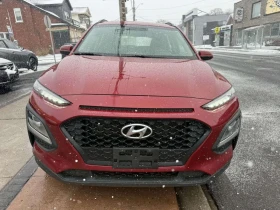 Hyundai Kona 2.0L Essential  - 12350 € / 24154.50 лв. - 96941585 2