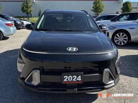 Hyundai Kona - 21400 € - 66734126 13