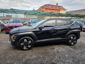 Hyundai Kona 2.0 HTRAC * ULTIMATE  - 22990 € / 44964.53 лв. - 11072773 4